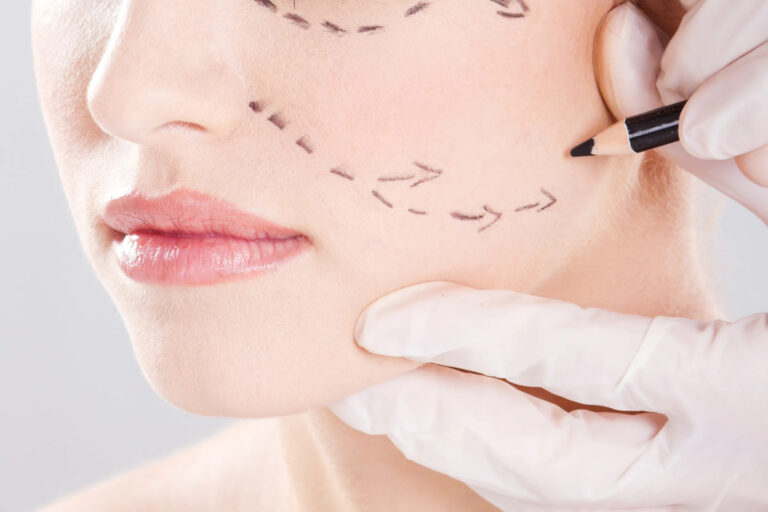 What Are the Latest Innovations in Facelift Surgery?